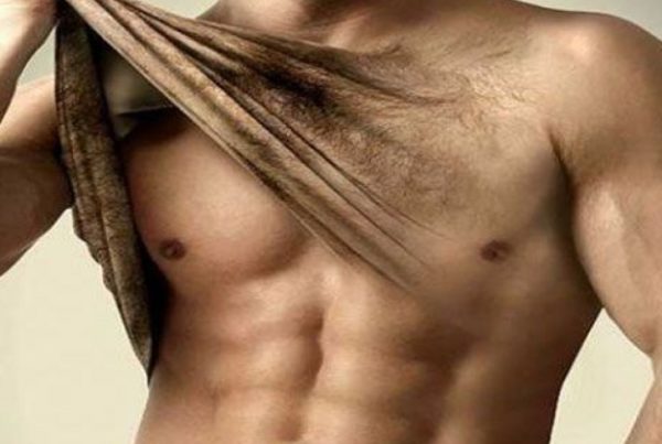 laser hair removal in men