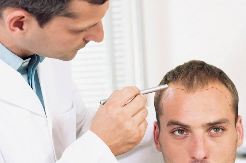Who is a trichologist and why should you fix an appointment with him?